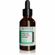 Revuele Azelaic Acid 10% Serum 30ml