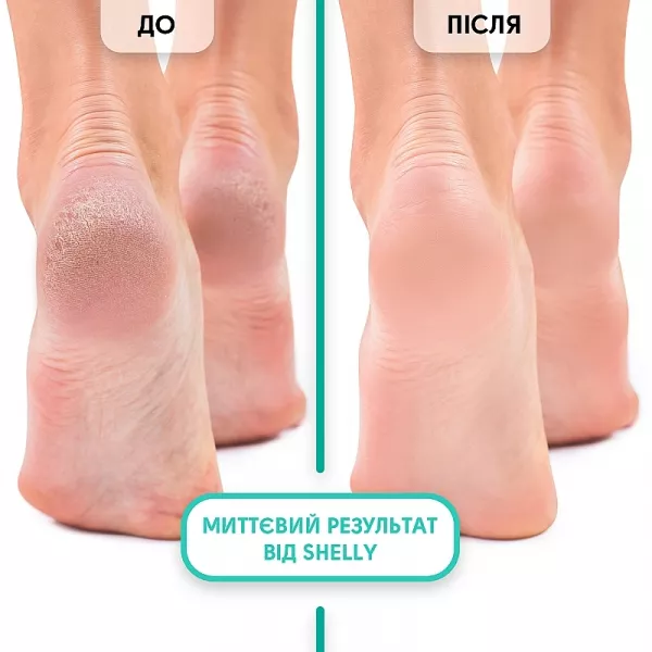 Shelly Professional Care Soft Blade Foot Callus Softening Foam ϳ���� �������-����'������� ��� �������� 
