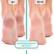 Shelly Professional Care Soft Blade Foot Callus Softening Foam ϳ���� �������-����'������� ��� �������� 