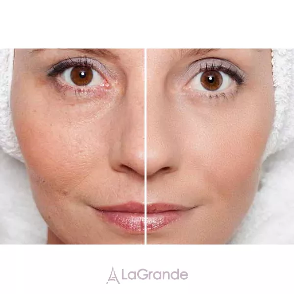 Kiehl's Dermatologist Solutions Precision Lifting & Pore-tightening Concentrate ������������� � �������������� ���� ����������