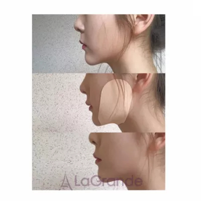 About Me Medianswer Collagen Lift Up Band    