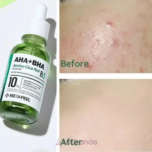 Medi-Peel AHA BHA Amino Cica-Nol B5 Ampoule ³������������ ��������� ��� ������� �� ��������� ���� �������