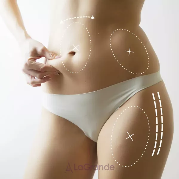 Arosha Body Rescue Lipolytic Cream �������������� ���� � ����������� ��������