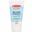 De La Cruz Acne Treatment with 5% Sulfur     5%    