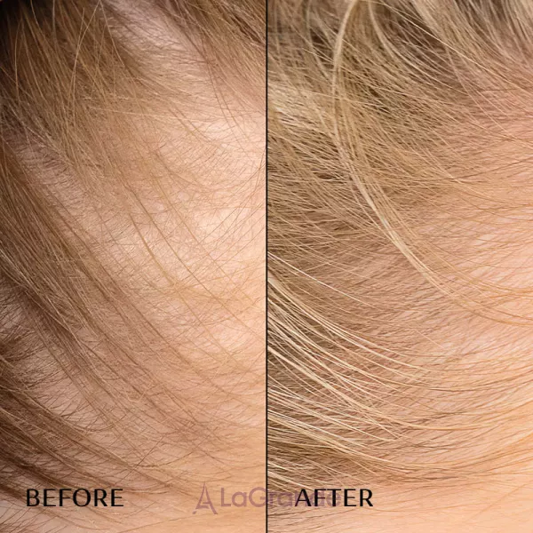 M2 Beaute Hair Activating Serum ��������� ��� �������